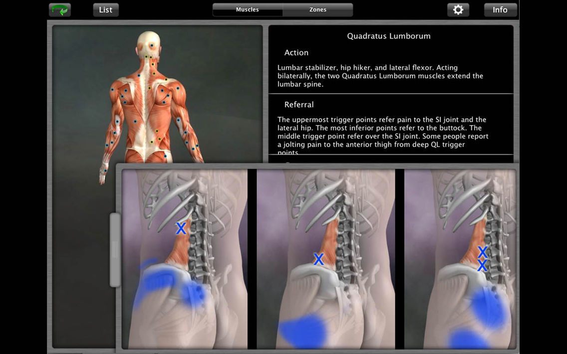 Muscle Trigger Point Anatomy - Know the Body