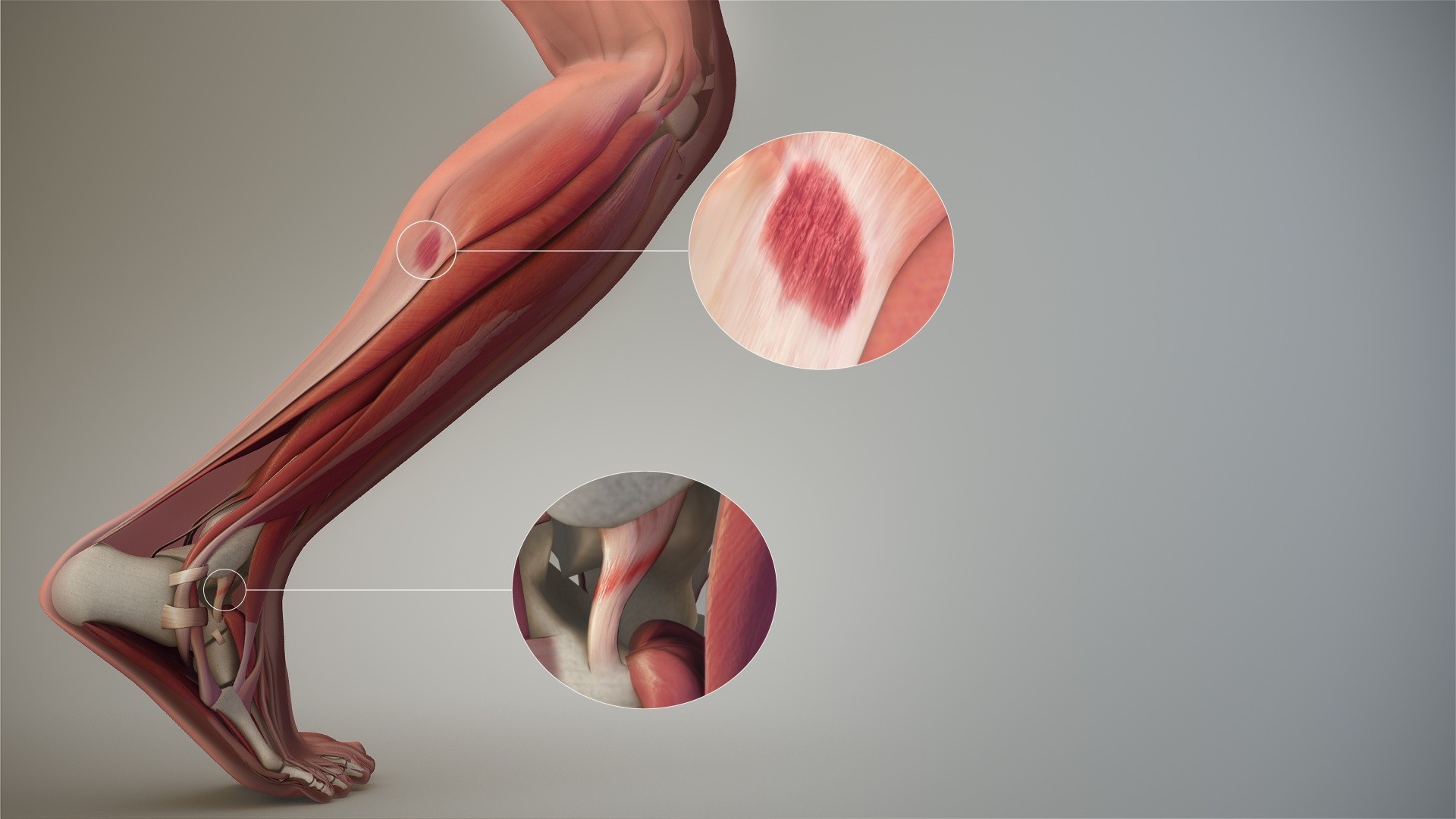 Muscle Trigger Point Anatomy - Know the Body