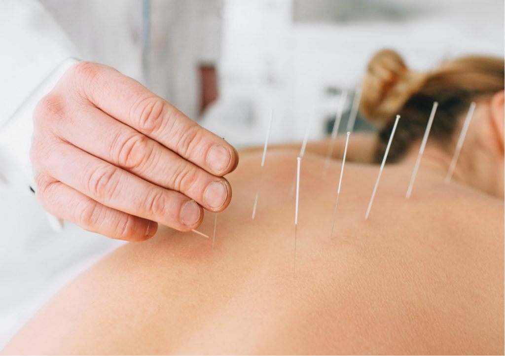 Acupuncture Assistant - Learn the Right Spots